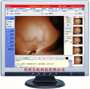 供应杰软红外乳腺影像系统工作站